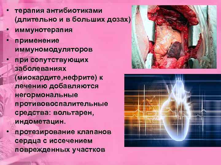 • терапия антибиотиками (длительно и в больших дозах) • иммунотерапия • применение иммуномодуляторов