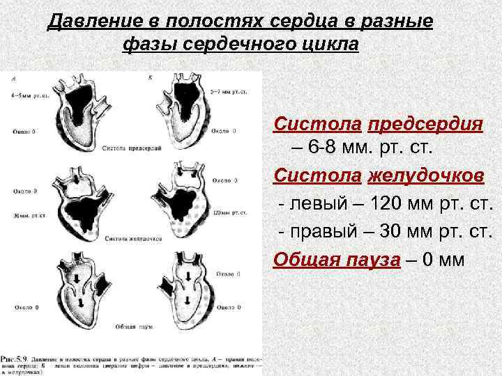 Расширение полостей сердца