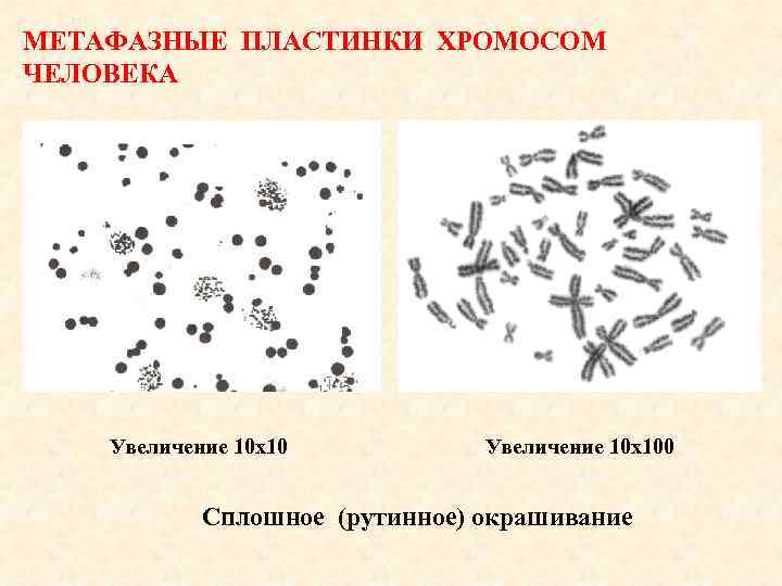 МЕТАФАЗНЫЕ ПЛАСТИНКИ ХРОМОСОМ ЧЕЛОВЕКА Увеличение 10 х100 Сплошное (рутинное) окрашивание 