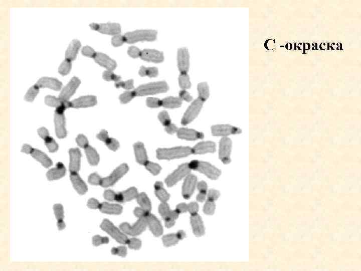 Изменение окраски хромосом. Методы дифференциальной окраски хромосом. Дифференциальная окраска хромосом. C метод окрашивания хромосом. Методы дифференциального окрашивания хромосом.