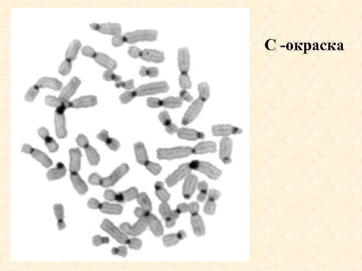 Окраска хромосом