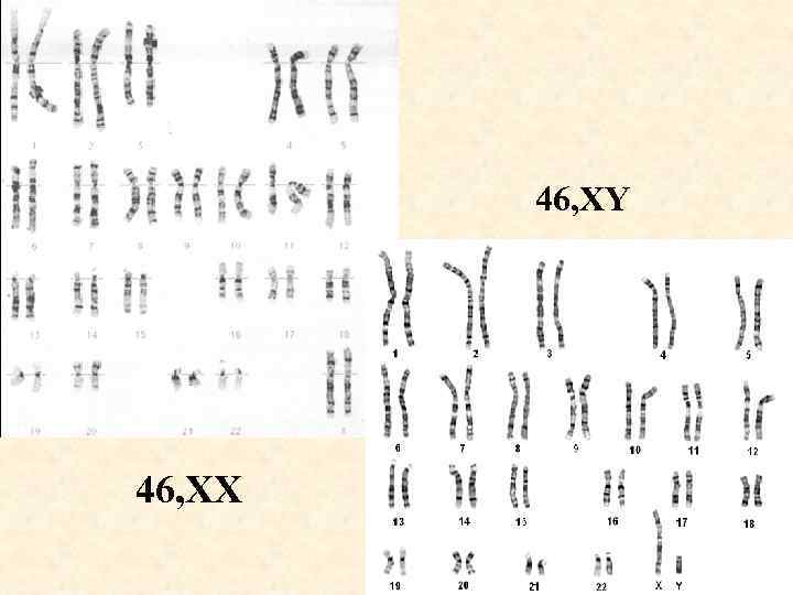 1 хромосома человека. 46 XY. 46 XX.