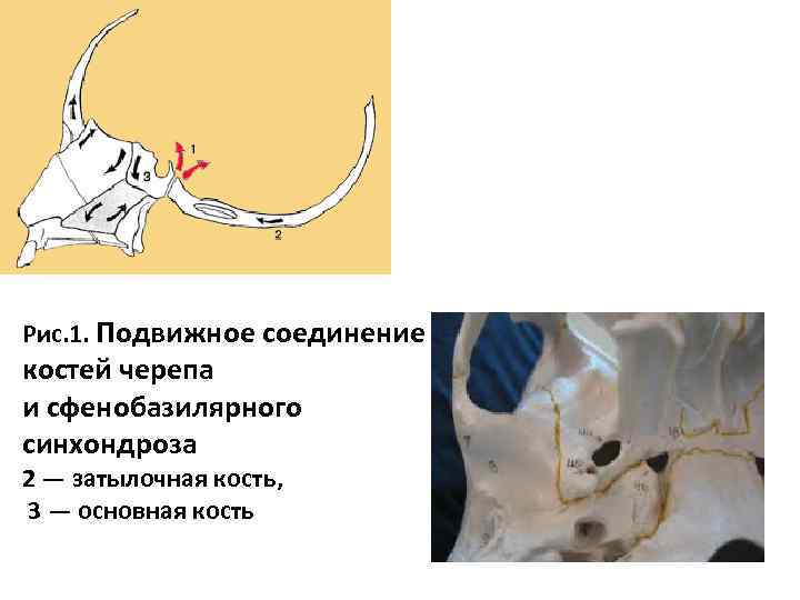 Рис. 1. Подвижное соединение костей черепа и сфенобазилярного синхондроза 2 — затылочная кость, 3