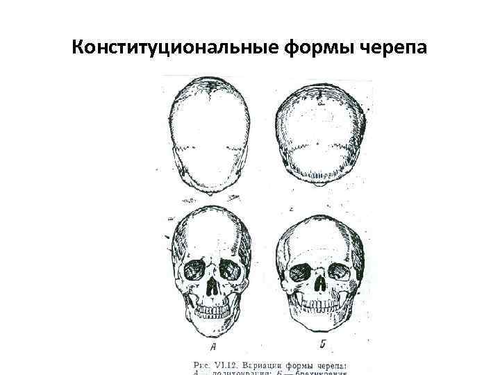 Конституциональные формы черепа 