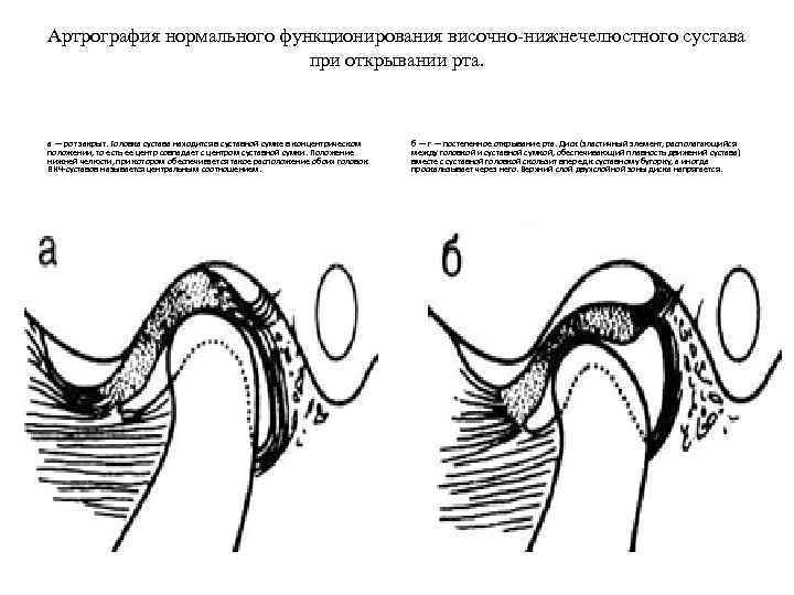 Смещение положения рисунка