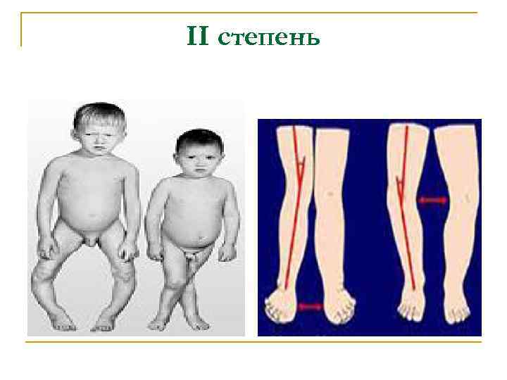 II степень 