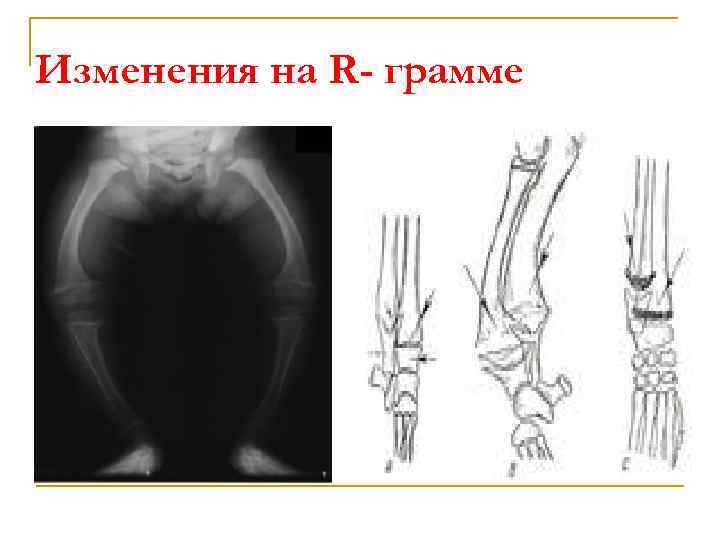 Изменения на R- грамме 