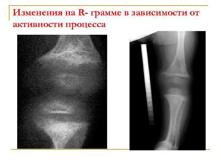 Изменения на R- грамме в зависимости от активности процесса 