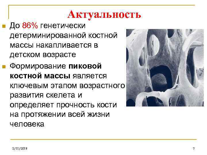 Актуальность n n До 86% генетически детерминированной костной массы накапливается в детском возрасте Формирование