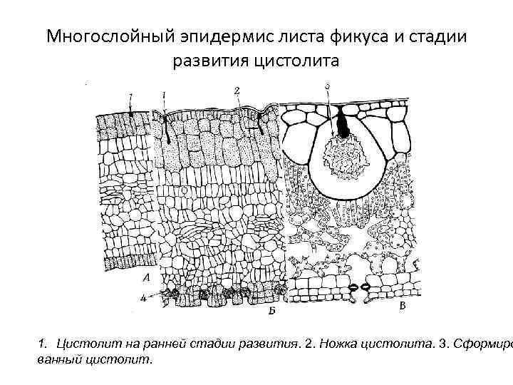 Многослойный эпидермис листа фикуса и стадии развития цистолита 1. Цистолит на ранней стадии развития.