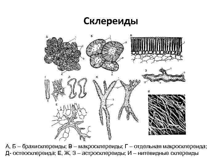 Склереиды А, Б – брахисклереиды; В – макросклереиды; Г – отдельная макросклереида; Д- остеосклереида;