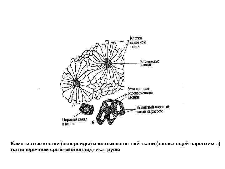 Каменистые клетки (склереиды) и клетки основной ткани (запасающей паренхимы) на поперечном срезе околоплодника груши