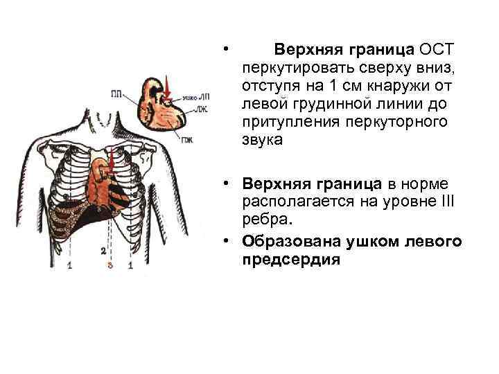  • Верхняя граница ОСТ перкутировать сверху вниз, отступя на 1 см кнаружи от