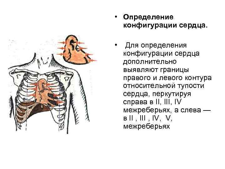  • Определение конфигурации сердца. • Для определения конфигурации сердца дополнительно выявляют границы правого