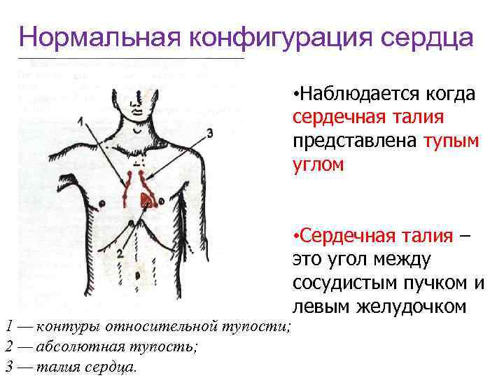 Нормальная конфигурация сердца • Наблюдается когда сердечная талия представлена тупым углом 1 — контуры