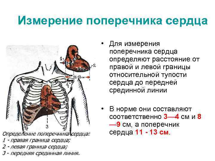 Измерение поперечника сердца • Для измерения поперечника сердца определяют расстояние от правой и левой