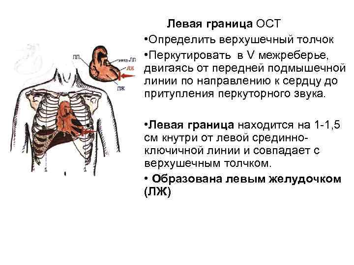 Левая граница ОСТ • Определить верхушечный толчок • Перкутировать в V межреберье, двигаясь от