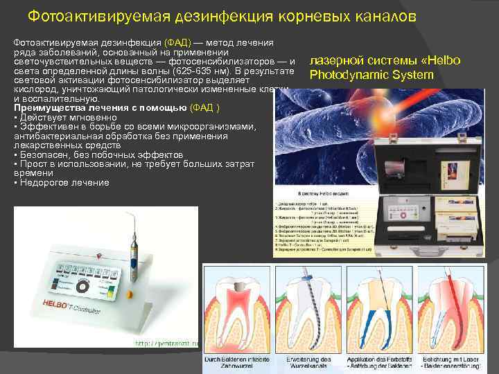 Фотоактивируемая дезинфекция корневых каналов Фотоактивируемая дезинфекция (ФАД) — метод лечения ряда заболеваний, основанный на