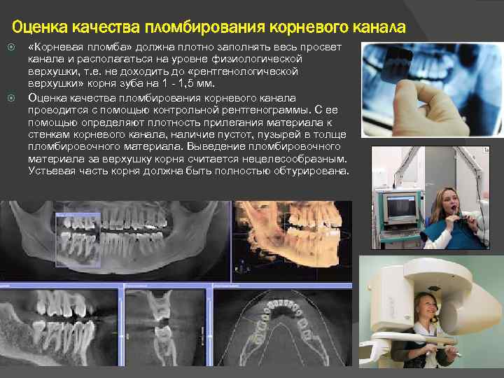 Оценка качества пломбирования корневого канала «Корневая пломба» должна плотно заполнять весь просвет канала и