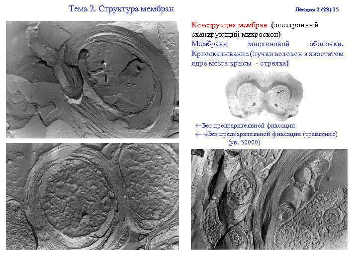 Тема 2. Структура мембран Лекция 2 (28) 15 Конструкция мембран (электронный сканирующий микроскоп) Мембраны