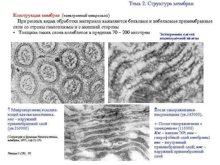 Тема 2. Структура мембран Конструкция мембран (электронный микроскоп) При разных видах обработки материала выявляются