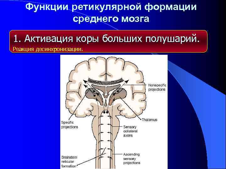 Ретикулярная формация фото