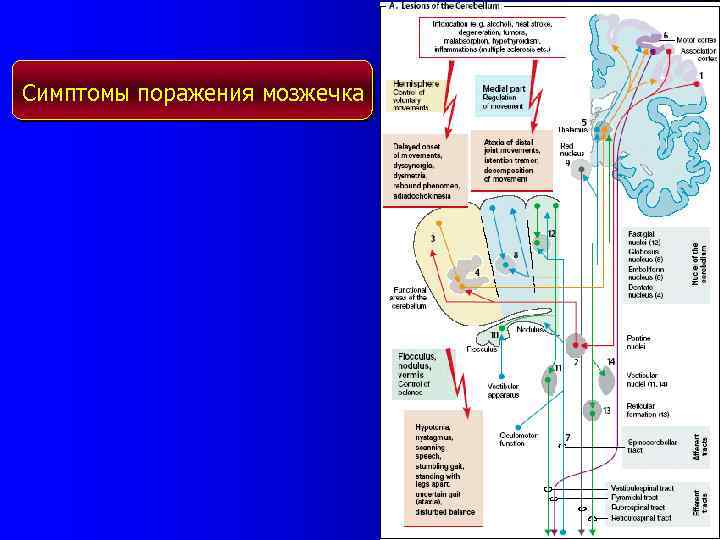 Симптомы поражения мозжечка 