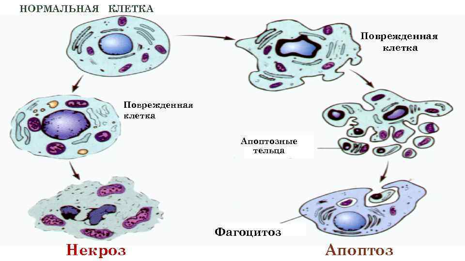 НОРМАЛЬНАЯ КЛЕТКА Поврежденная клетка Апоптозные тельца Фагоцитоз Некроз Апоптоз 