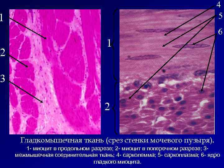 4 5 1 2 6 1 3 2 Гладкомышечная ткань (срез стенки мочевого пузыря).