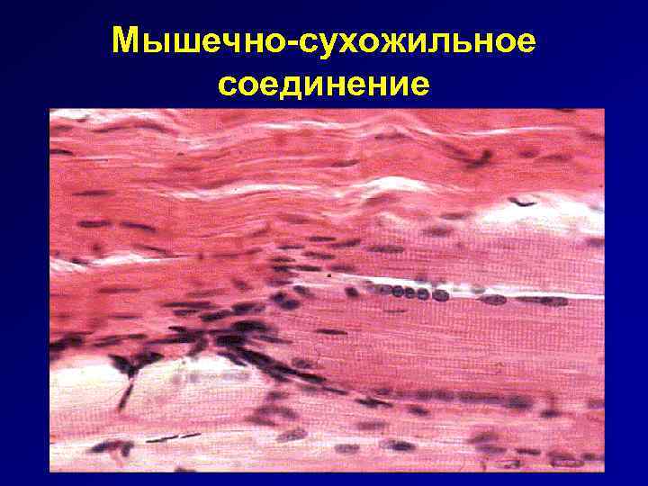 Мышечно-сухожильное соединение 
