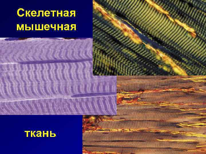 Скелетная мышечная ткань 