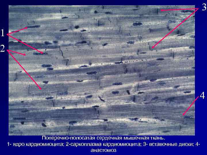 3 1 2 4 Поперечно-полосатая сердечная мышечная ткань. 1 - ядро кардиомиоцита; 2 -саркоплазма