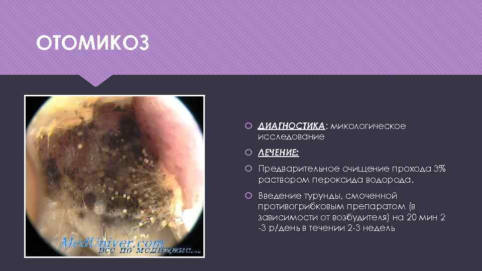 ОТОМИКОЗ ДИАГНОСТИКА: микологическое исследование ЛЕЧЕНИЕ: Предварительное очищение прохода 3% раствором пероксида водорода. Введение турунды,