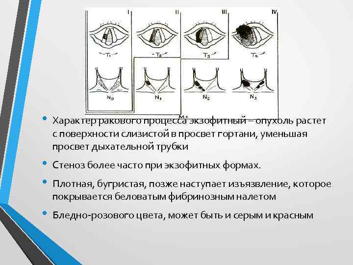  • Характер ракового процесса экзофитный – опухоль растет с поверхности слизистой в просвет