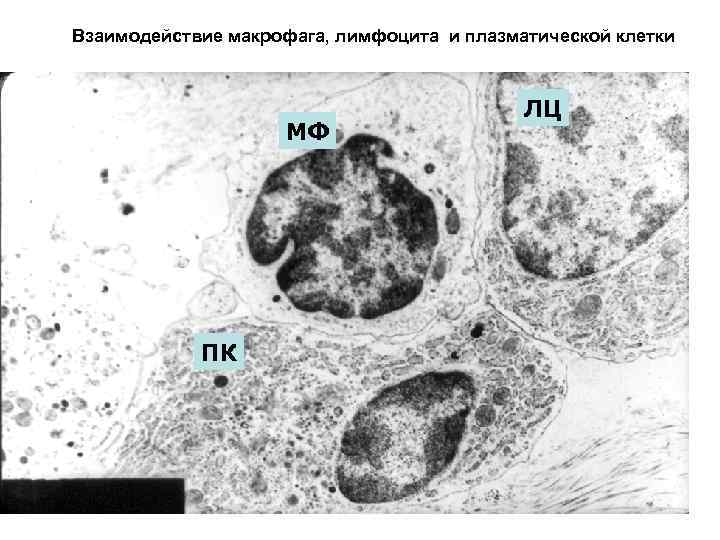 Взаимодействие макрофага, лимфоцита и плазматической клетки МФ ПК ЛЦ 