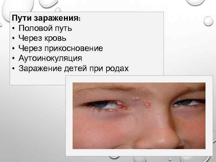 Пути заражения: • Половой путь • Через кровь • Через прикосновение • Аутоинокуляция •