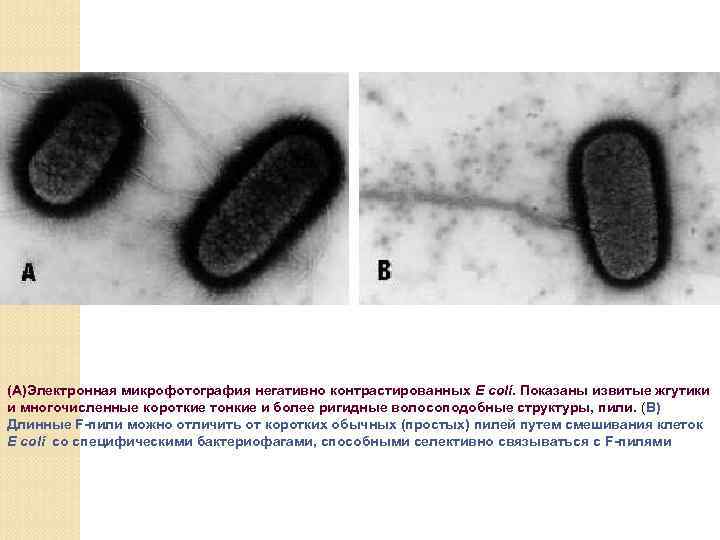 (А)Электронная микрофотография негативно контрастированных E coli. Показаны извитые жгутики и многочисленные короткие тонкие и