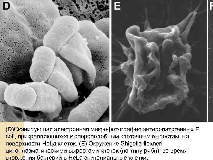 (D)Сканирующая электронная микрофотография энтеропатогенных Е. coli, прикрепляющихся к опороподобным клеточным выростам на поверхности He.