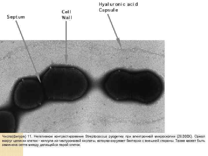 Число(фигура) 11. Негативное контрастирование Streptococcus pyogenes при электронной микроскопии (28, 000 X). Ореол вокруг