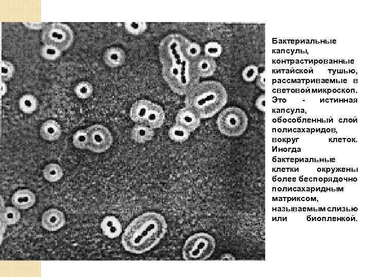 Бактериальные капсулы, контрастированные китайской тушью, рассматриваемые в световой микроскоп. Это истинная капсула, обособленный слой