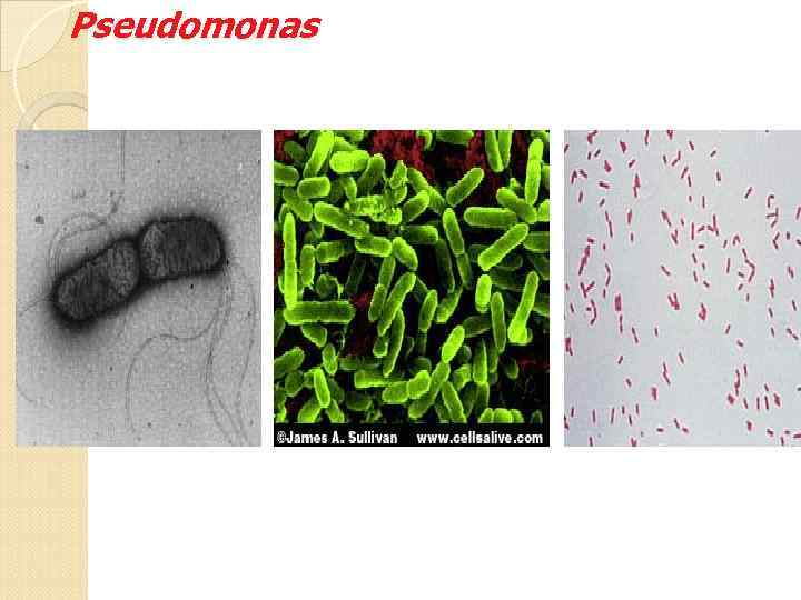 Pseudomonas 