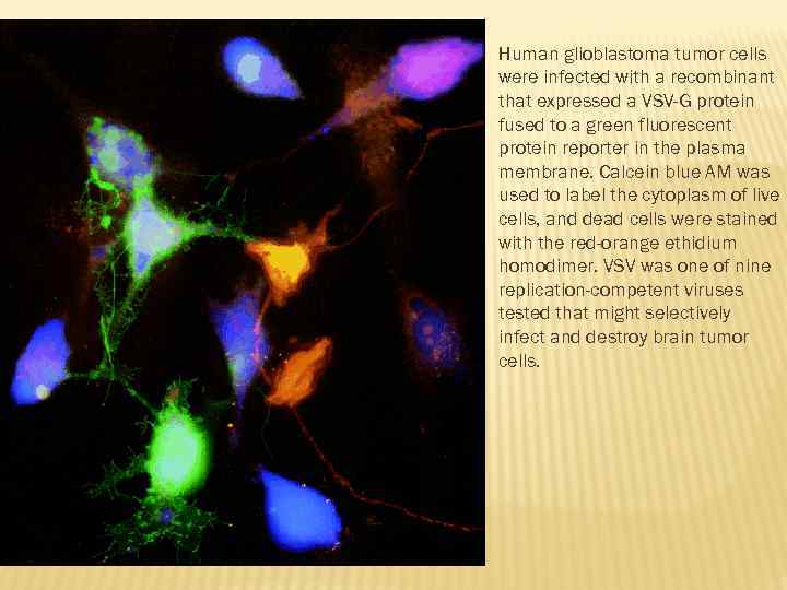  Human glioblastoma tumor cells were infected with a recombinant that expressed a VSV-G