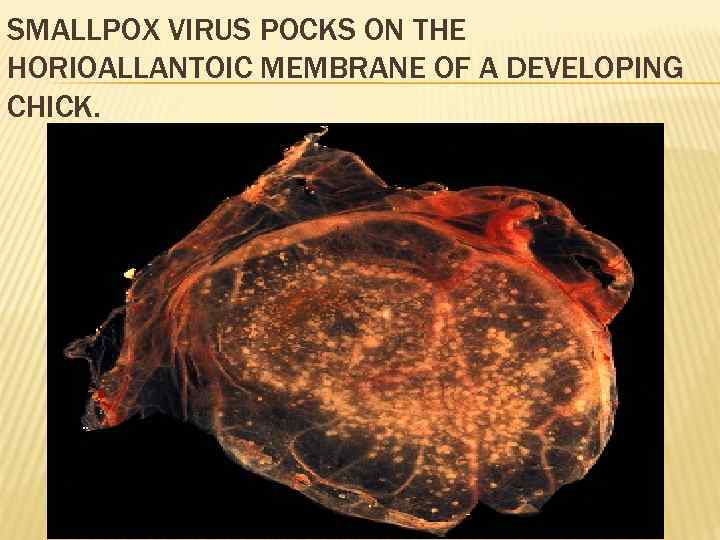 SMALLPOX VIRUS POCKS ON THE HORIOALLANTOIC MEMBRANE OF A DEVELOPING CHICK. 