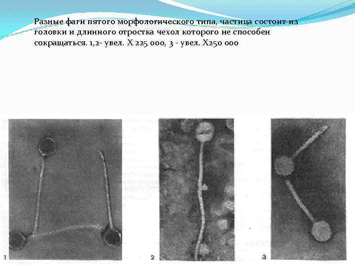 Разные фаги пятого морфологического типа, частица состоит из головки и длинного отростка чехол которого