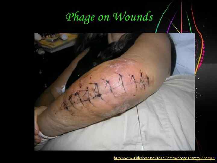 http: //www. slideshare. net/Fa. To. Oo. Maa/phage-therapy-6802754 