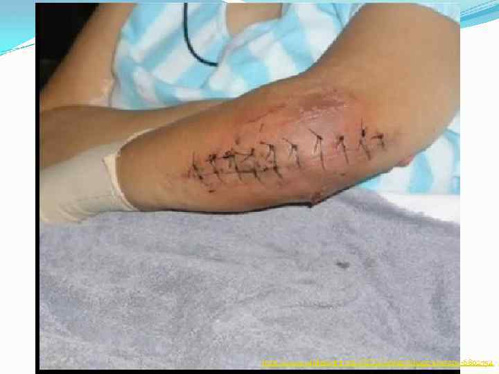 http: //www. slideshare. net/Fa. To. Oo. Maa/phage-therapy-6802754 