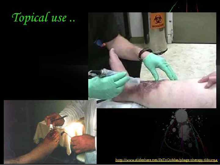 http: //www. slideshare. net/Fa. To. Oo. Maa/phage-therapy-6802754 