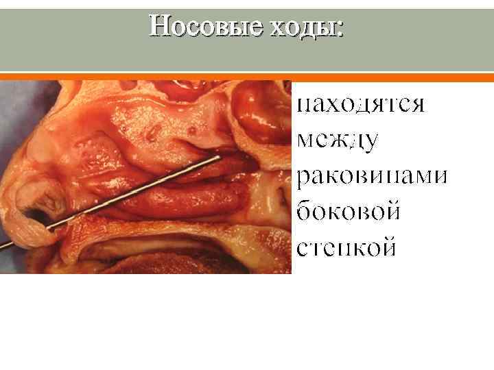 Носовые ходы: находятся между раковинами боковой стенкой 