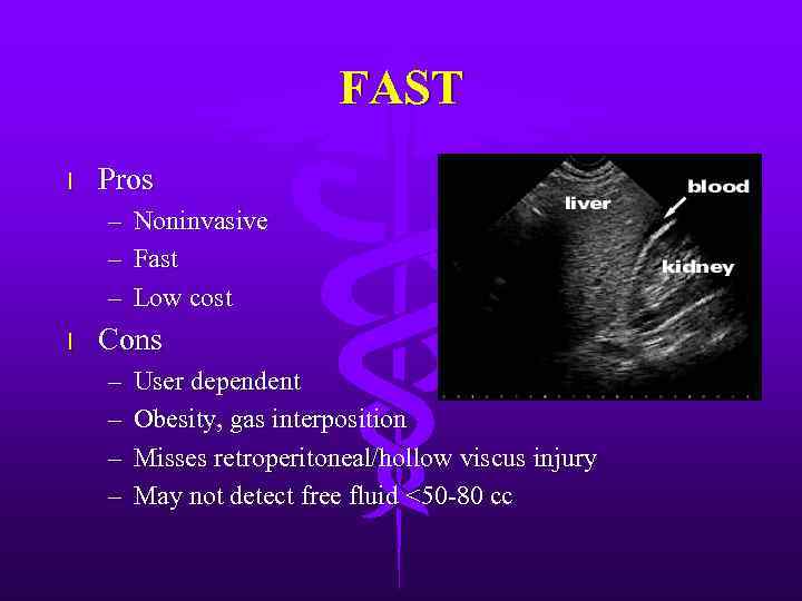 FAST l Pros – Noninvasive – Fast – Low cost l Cons – –