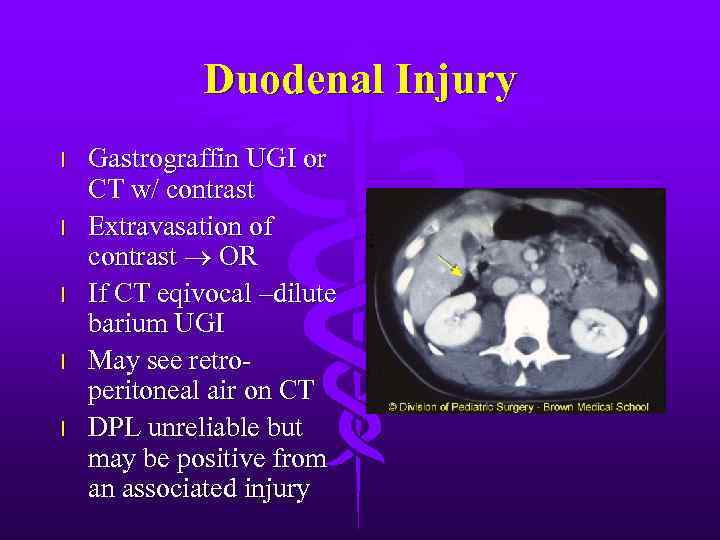 Duodenal Injury l l l Gastrograffin UGI or CT w/ contrast Extravasation of contrast